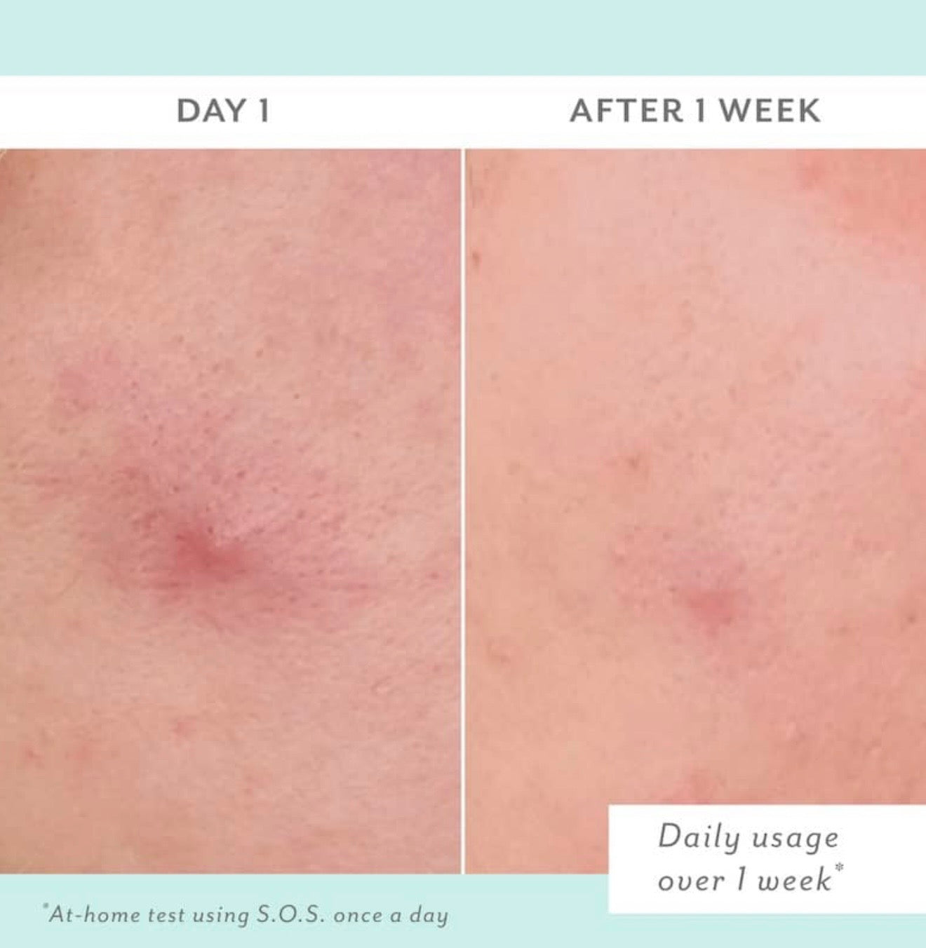 Patchology S.O.S Totally Invisible Clarifying Liquid Patch