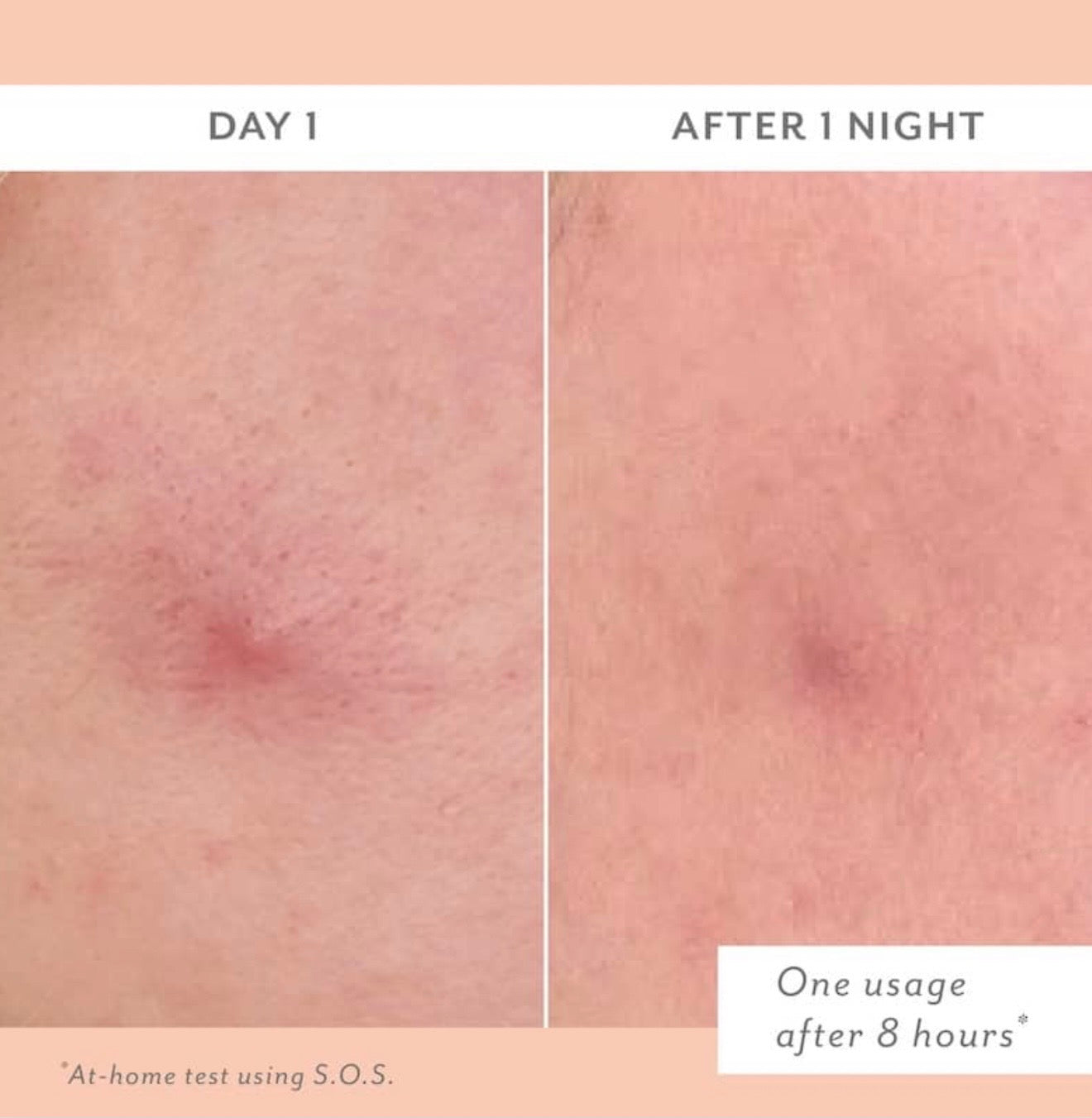 Patchology S.O.S Totally Invisible Clarifying Liquid Patch